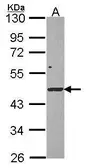 Anti-DRAK1 antibody [N3C3] used in Western Blot (WB). GTX107969