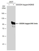 Anti-IKK beta antibody used in Western Blot (WB). GTX107970