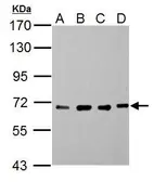 Anti-Nucleoporin p62 antibody used in Western Blot (WB). GTX107973