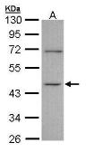 Anti-ITPK1 antibody [N3C3] used in Western Blot (WB). GTX107974