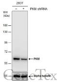 Anti-PKM antibody used in Western Blot (WB). GTX107977