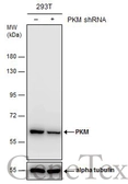 Anti-PKM antibody used in Western Blot (WB). GTX107977