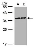Anti-PDLIM1 antibody [C2C3], C-term used in Western Blot (WB). GTX107981
