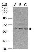 Anti-EPM2AIP1 antibody [N1], N-term used in Western Blot (WB). GTX107983