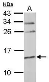 Anti-Cystatin C antibody used in Western Blot (WB). GTX107986