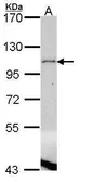 Anti-Lipin 1 antibody [C3], C-term used in Western Blot (WB). GTX107992