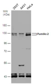 Anti-Pumilio 2 antibody [N1N2], N-term used in Western Blot (WB). GTX107995