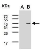Anti-GCIP interacting protein p29 antibody [C2C3], C-term used in Western Blot (WB). GTX107998