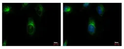 Anti-ARFGAP3 antibody [C3], C-term used in Immunocytochemistry/ Immunofluorescence (ICC/IF). GTX107999