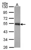 Anti-PACSIN3 antibody [N1], N-term used in Western Blot (WB). GTX108004