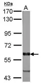 Anti-VAM1 antibody [N1], N-term used in Western Blot (WB). GTX108010