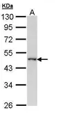 Anti-WWOX antibody [N1N2], N-term used in Western Blot (WB). GTX108011
