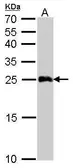 Anti-GSTA1 antibody used in Western Blot (WB). GTX108012