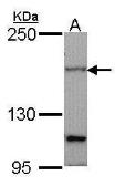 Anti-PTCH1 antibody used in Western Blot (WB). GTX108015