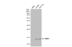 Anti-RBP1 antibody used in Western Blot (WB). GTX108016