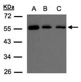 Anti-OSBPL2 antibody [C3], C-term used in Western Blot (WB). GTX108020