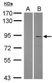 Anti-TRIM2 antibody [C3], C-term used in Western Blot (WB). GTX108027