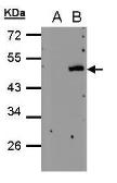 Anti-PSCD4 antibody [N1], N-term used in Western Blot (WB). GTX108032