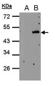 Anti-PSCD4 antibody [N1], N-term used in Western Blot (WB). GTX108032