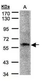 Anti-PRAM1 antibody [C3], C-term used in Western Blot (WB). GTX108042