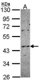 Anti-NOXO1 antibody [C2C3], C-term used in Western Blot (WB). GTX108043