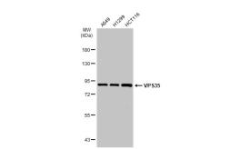 Anti-VPS35 antibody [C3], C-term used in Western Blot (WB). GTX108058