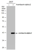 Anti-Centaurin alpha 2 antibody [C3], C-term used in Western Blot (WB). GTX108059