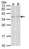 Anti-TGF beta induced factor 2 antibody used in Western Blot (WB). GTX108069