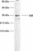 Anti-BAK antibody [TC100] used in Western Blot (WB). GTX10808