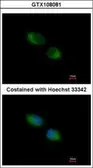 Anti-TXNDC1 antibody [C2C3], C-term used in Immunocytochemistry/ Immunofluorescence (ICC/IF). GTX108081