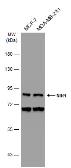 Anti-NIR1 antibody [C3], C-term used in Western Blot (WB). GTX108085