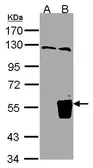 Anti-TRIM15 antibody [N1], N-term used in Western Blot (WB). GTX108094