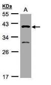 Anti-GIPC3 antibody [N1], N-term used in Western Blot (WB). GTX108100