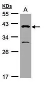 Anti-GIPC3 antibody [N1], N-term used in Western Blot (WB). GTX108100