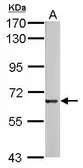 Anti-Melanophilin antibody [C3], C-term used in Western Blot (WB). GTX108104