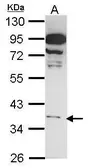 Anti-GPR81 antibody [N1], N-term used in Western Blot (WB). GTX108111