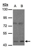 Anti-Mu Opioid receptor antibody [N1], N-term used in Western Blot (WB). GTX108125