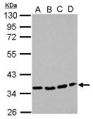 Anti-P2Y12 antibody [N1], N-term used in Western Blot (WB). GTX108143
