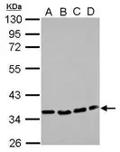 Anti-P2Y12 antibody [N1], N-term used in Western Blot (WB). GTX108143