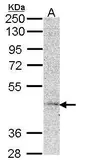 Anti-MC5R antibody [N1], N-term used in Western Blot (WB). GTX108149
