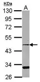 Anti-CCRL2 antibody [N1], N-term used in Western Blot (WB). GTX108151
