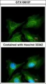 Anti-5-HT7 receptor antibody [N1], N-term used in Immunocytochemistry/ Immunofluorescence (ICC/IF). GTX108157