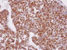 Anti-XPR1 antibody [N1], N-term used in IHC (Paraffin sections) (IHC-P). GTX108158