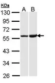 Anti-Kappa Opioid Receptor antibody used in Western Blot (WB). GTX108164