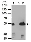Anti-ERR alpha antibody [N1], N-term used in Immunoprecipitation (IP). GTX108166
