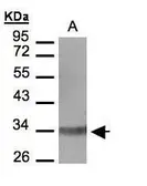 Anti-Leukotriene B4 Receptor antibody [N1], N-term used in Western Blot (WB). GTX108169