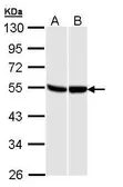 Anti-GPR87 antibody used in Western Blot (WB). GTX108170