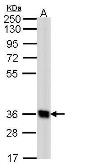 Anti-GPR62 antibody [N1], N-term used in Western Blot (WB). GTX108172