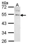 Anti-GRPR antibody [N1], N-term used in Western Blot (WB). GTX108176