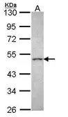 Anti-CRHR2 antibody [N1], N-term used in Western Blot (WB). GTX108177